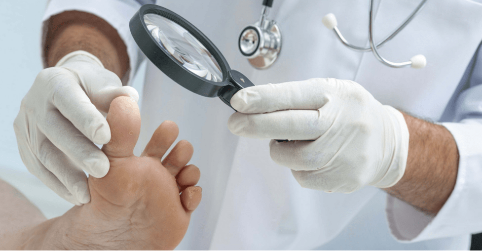 The first symptoms of leg fungus