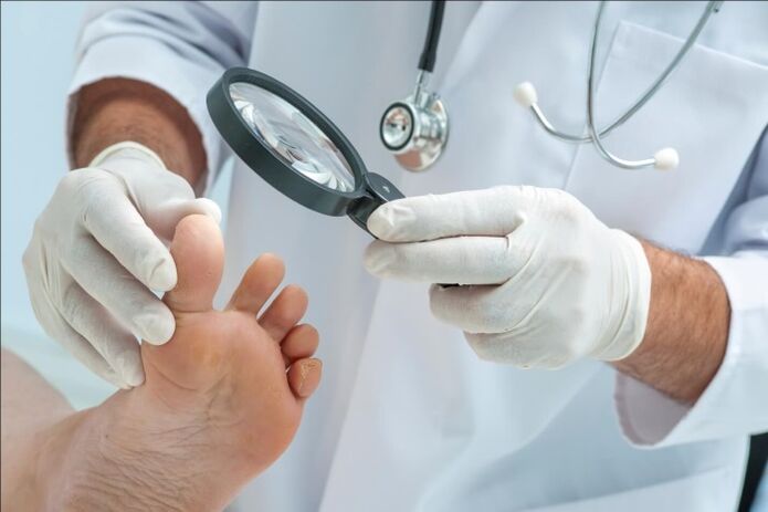 Before prescribing a treatment for toenail fungus, the doctor will perform an examination